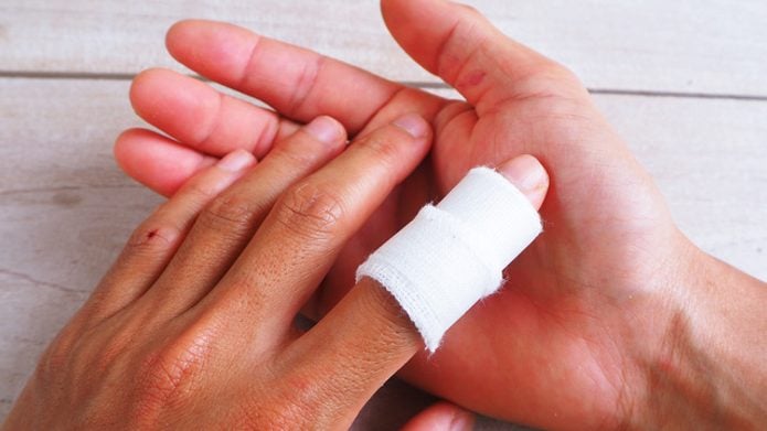 Finger-Verstauchung: Die besten Tipps