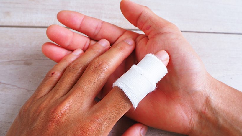 Die besten Tipps bei Finger-Verstauchung